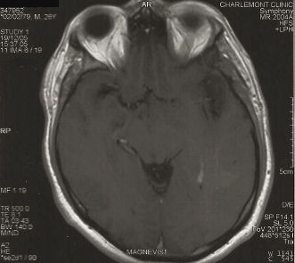 Smiley Brain